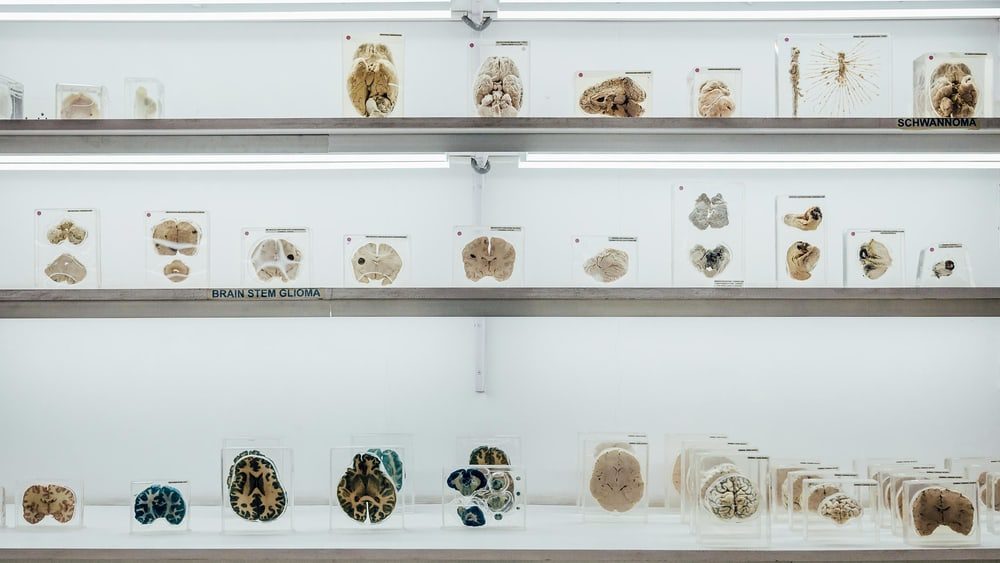 BRAIN POWER: The museum where you can hold a HUMAN BRAIN